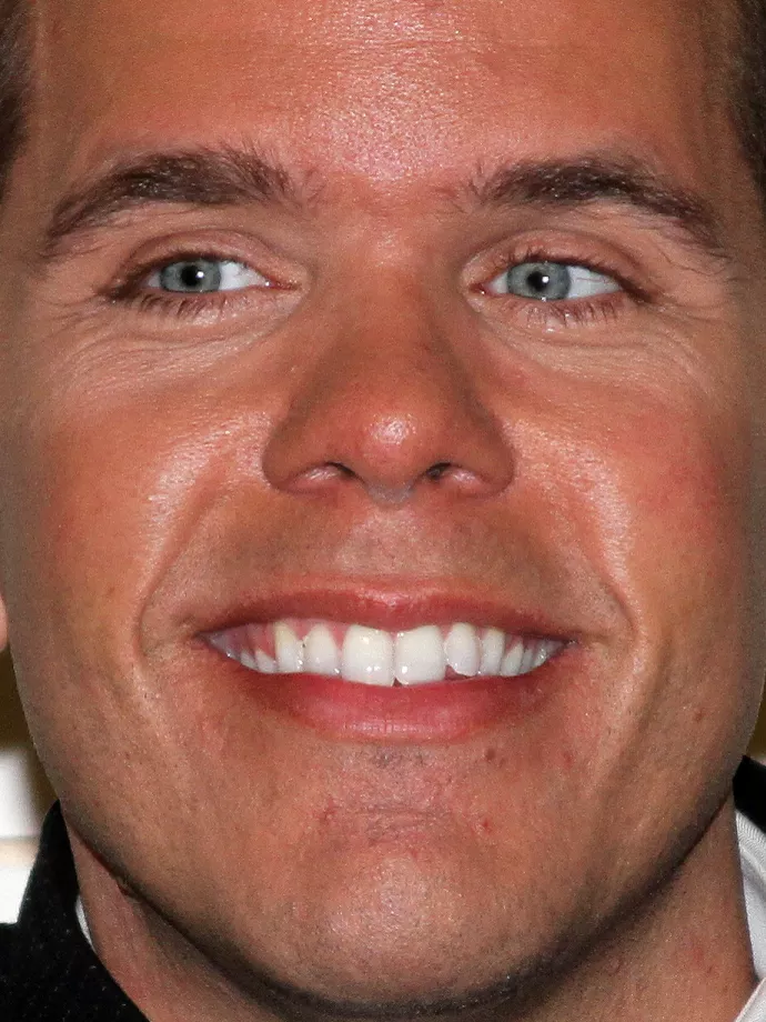 Perez Hilton, celebblogger élő közvetítésben kísérelt meg öngyilkosságot